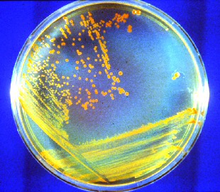 Deinococcus radiodurans (foto di Michael Daly)