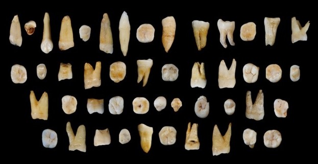 I 47 denti umani rinvenuti nella caverna di Daoxian